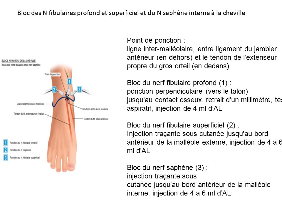 ALR aux urgences Limitation nombre points d injection ppt video